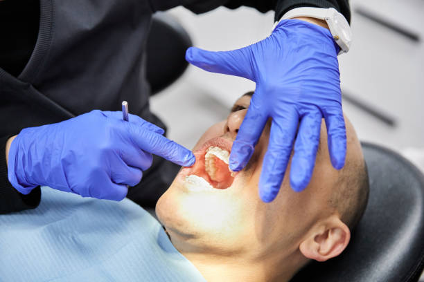 Best Teeth Whitening  in Comstock Park, MI